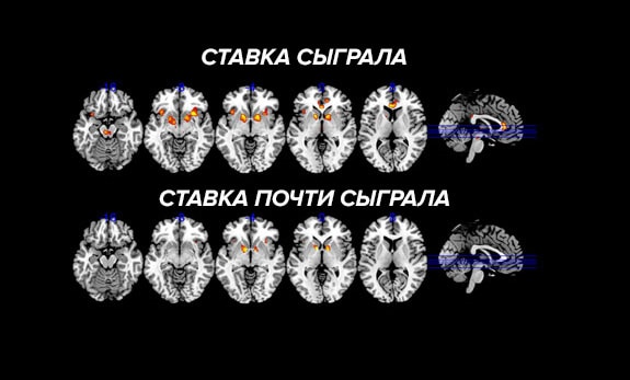 Мозговая активность ставки на спорт